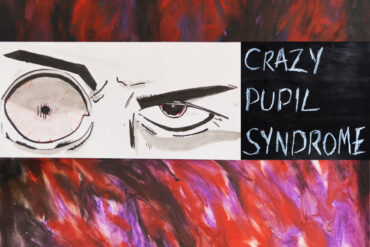 Crazy Pupil Syndrome